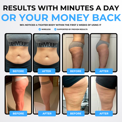 VapoShine LymphaSculpt™: Quad-Action Lymphatic Drainage Massager