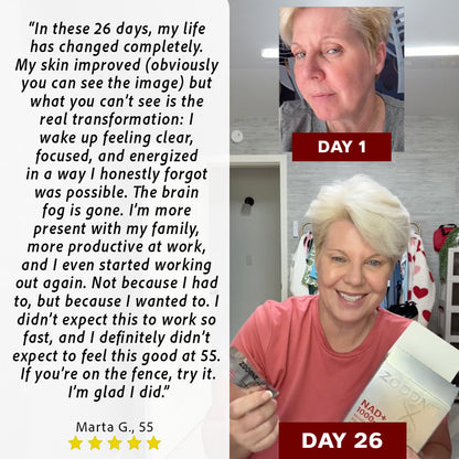 VapoShine Zooone™ NAD+ Berry Flavor Drink Mix